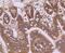 Laminin Subunit Beta 1 antibody, A03894-2, Boster Biological Technology, Immunohistochemistry paraffin image 