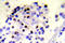 H2A Histone Family Member X antibody, LS-C178091, Lifespan Biosciences, Immunohistochemistry paraffin image 