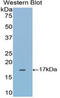 Glycoprotein Ib Platelet Subunit Beta antibody, LS-C294298, Lifespan Biosciences, Western Blot image 