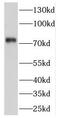 Cleavage And Polyadenylation Specific Factor 3 antibody, FNab01938, FineTest, Western Blot image 