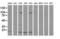 Destrin antibody, LS-C785809, Lifespan Biosciences, Western Blot image 