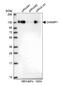 Chromosome Alignment Maintaining Phosphoprotein 1 antibody, NBP1-88402, Novus Biologicals, Western Blot image 