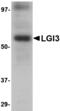 Leucine-rich repeat LGI family member 3 antibody, MBS150266, MyBioSource, Western Blot image 