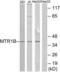 Melatonin Receptor 1B antibody, LS-C120750, Lifespan Biosciences, Western Blot image 