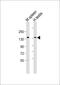 BCL9 Transcription Coactivator antibody, M04057, Boster Biological Technology, Western Blot image 