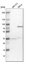 RNA Binding Motif Protein 47 antibody, HPA006347, Atlas Antibodies, Western Blot image 