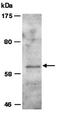Protein Arginine Methyltransferase 3 antibody, orb66860, Biorbyt, Western Blot image 
