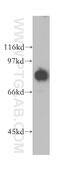 Segment polarity protein dishevelled homolog DVL-3 antibody, 13444-1-AP, Proteintech Group, Western Blot image 