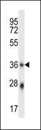Phospholipid Scramblase 4 antibody, 57-390, ProSci, Western Blot image 