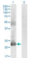 Coiled-Coil Domain Containing 115 antibody, LS-C134110, Lifespan Biosciences, Western Blot image 