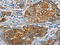 Nuclear receptor ROR-beta antibody, CSB-PA981363, Cusabio, Immunohistochemistry paraffin image 