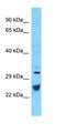 ATPase Na+/K+ Transporting Subunit Beta 1 antibody, orb330386, Biorbyt, Western Blot image 