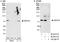 DEAD-Box Helicase 18 antibody, A300-635A, Bethyl Labs, Western Blot image 