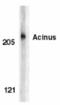 Apoptotic Chromatin Condensation Inducer 1 antibody, TA306029, Origene, Western Blot image 