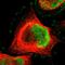 Myeloid Leukemia Factor 2 antibody, HPA010811, Atlas Antibodies, Immunocytochemistry image 