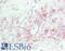 Phospholipase A2 Group IVA antibody, LS-B11332, Lifespan Biosciences, Immunohistochemistry frozen image 
