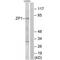 Zona Pellucida Glycoprotein 1 antibody, PA5-50167, Invitrogen Antibodies, Western Blot image 