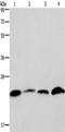 CKLF Like MARVEL Transmembrane Domain Containing 6 antibody, TA322303, Origene, Western Blot image 