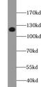 Xylosyltransferase 1 antibody, FNab09558, FineTest, Western Blot image 
