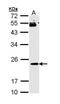 RAP1B, Member Of RAS Oncogene Family antibody, PA5-29396, Invitrogen Antibodies, Western Blot image 