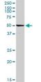 Complement Component 4 Binding Protein Alpha antibody, H00000722-D01P, Novus Biologicals, Western Blot image 