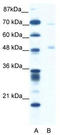 Pancreatic Lipase antibody, TA334301, Origene, Western Blot image 