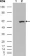 ETV1 antibody, abx010754, Abbexa, Enzyme Linked Immunosorbent Assay image 