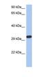 Capping Actin Protein Of Muscle Z-Line Subunit Alpha 3 antibody, orb330988, Biorbyt, Western Blot image 