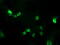 ALX Homeobox 4 antibody, M05075, Boster Biological Technology, Immunofluorescence image 