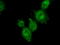 Mitogen-activated protein kinase 11 antibody, TA501085, Origene, Immunofluorescence image 