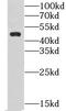 Carbohydrate Sulfotransferase 14 antibody, FNab01694, FineTest, Western Blot image 