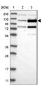 Zinc Finger Protein 592 antibody, NBP1-86646, Novus Biologicals, Western Blot image 