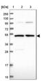 BPI Fold Containing Family B Member 6 antibody, NBP1-88372, Novus Biologicals, Western Blot image 