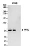 6-phosphofructokinase, liver type antibody, NBP2-32212, Novus Biologicals, Immunoprecipitation image 