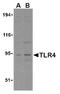Toll Like Receptor 4 antibody, AP05233PU-N, Origene, Western Blot image 