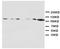 Glutamate Ionotropic Receptor NMDA Type Subunit 1 antibody, PA1222, Boster Biological Technology, Western Blot image 