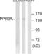 Protein Phosphatase 1 Regulatory Subunit 3A antibody, LS-C120261, Lifespan Biosciences, Western Blot image 