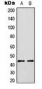 ETS Transcription Factor ELK3 antibody, GTX32324, GeneTex, Western Blot image 