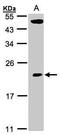 TP53RK Binding Protein antibody, PA5-21792, Invitrogen Antibodies, Western Blot image 
