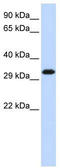 Gem Nuclear Organelle Associated Protein 2 antibody, TA345721, Origene, Western Blot image 