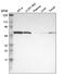 Ro60, Y RNA Binding Protein antibody, HPA005142, Atlas Antibodies, Western Blot image 