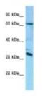 Defective In Cullin Neddylation 1 Domain Containing 4 antibody, NBP1-98384, Novus Biologicals, Western Blot image 