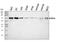 Decapping MRNA 1A antibody, A04587-2, Boster Biological Technology, Western Blot image 
