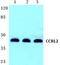 C-C Motif Chemokine Receptor Like 2 antibody, PA5-75492, Invitrogen Antibodies, Western Blot image 