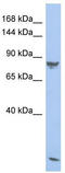 Rod cGMP-specific 3 ,5 -cyclic phosphodiesterase subunit alpha antibody, TA335152, Origene, Western Blot image 