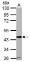 Serpin Family E Member 2 antibody, PA5-32163, Invitrogen Antibodies, Western Blot image 