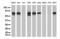 NBS antibody, UM800030CF, Origene, Western Blot image 