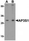 AP-3 complex subunit sigma-1 antibody, TA319631, Origene, Western Blot image 