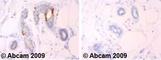 Cyclin Dependent Kinase 1 antibody, ab18, Abcam, Immunohistochemistry paraffin image 