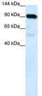 Lysine Methyltransferase 5B antibody, TA335571, Origene, Western Blot image 